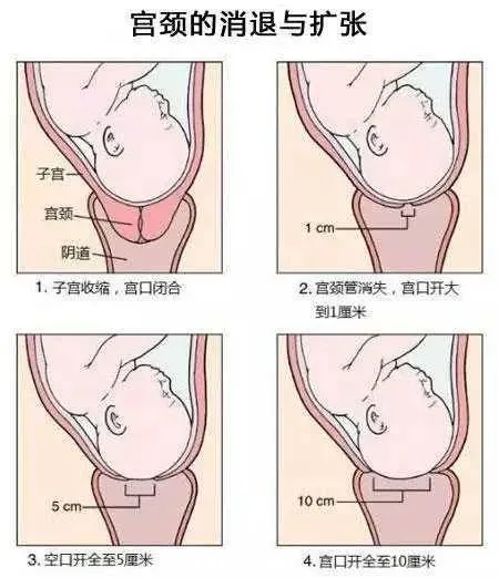 「急產」真的好嗎？揭露醫學上的真相